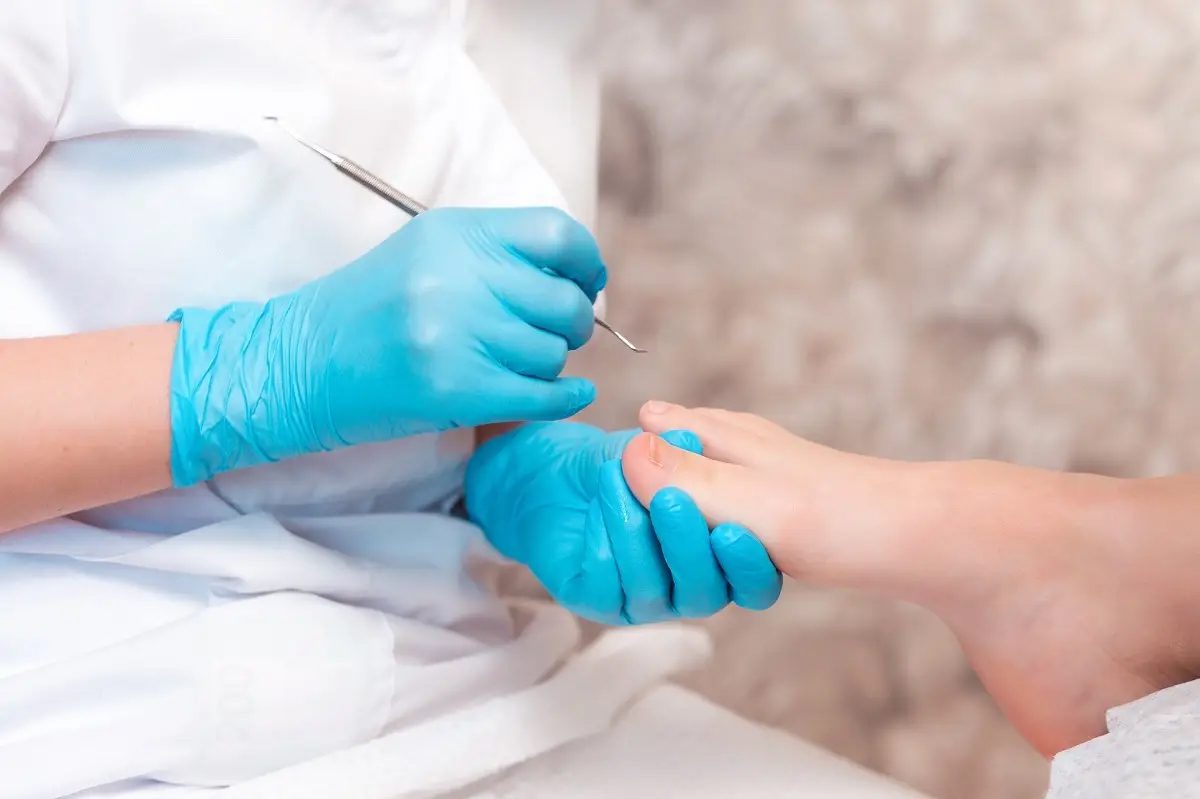 Course Spotlight: Nail Surgery with the APodA image