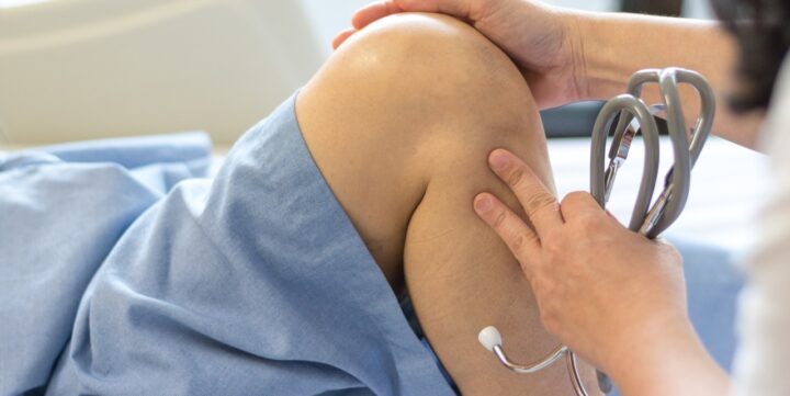 Does an ACL rupture always need surgery? image