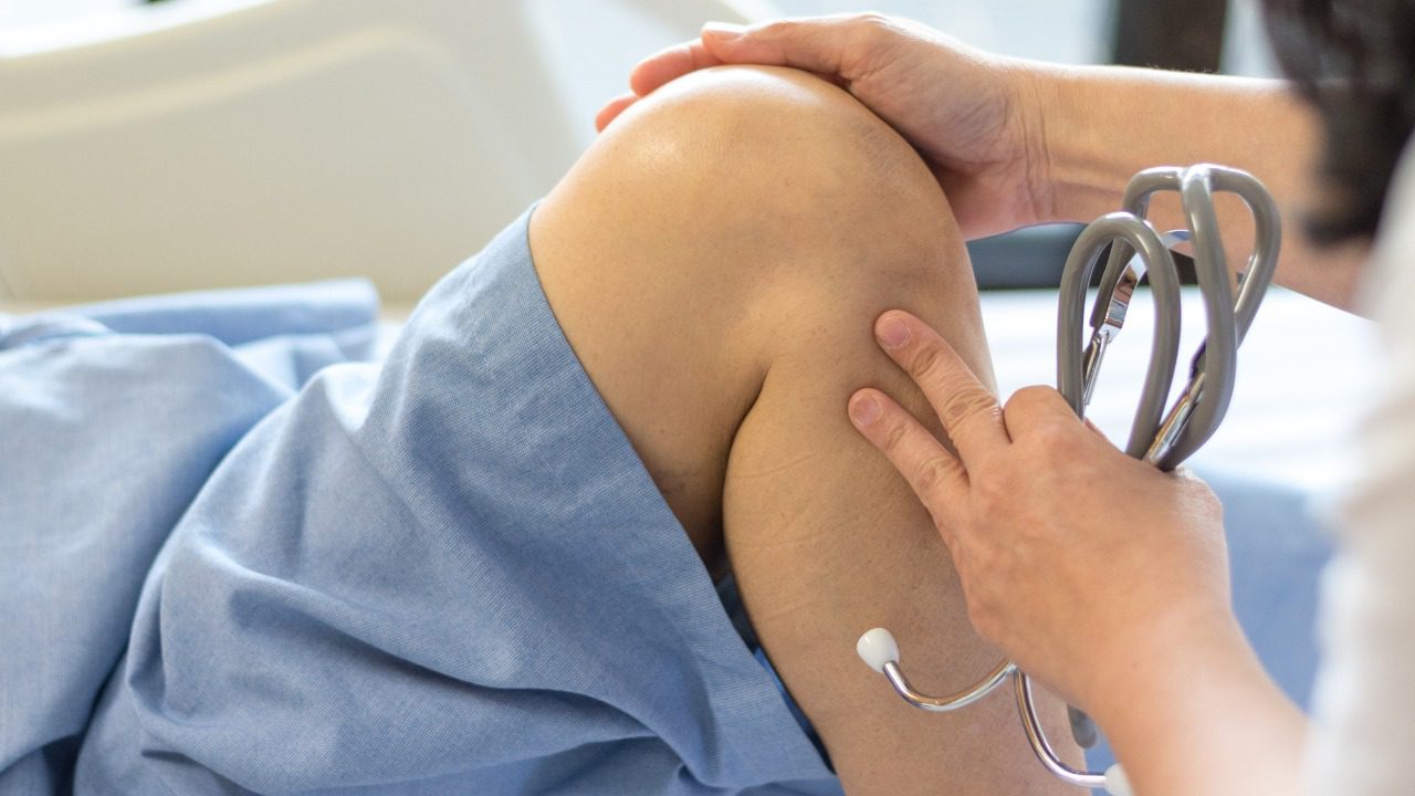 Med CPD | Does an ACL rupture always need surgery? Does an ACL rupture always need surgery? image